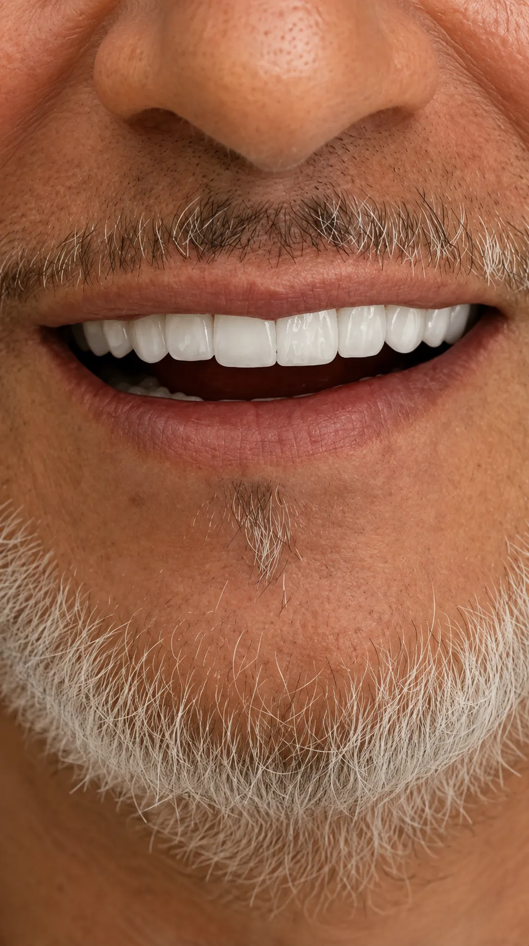 Impianti dentali JokaDent